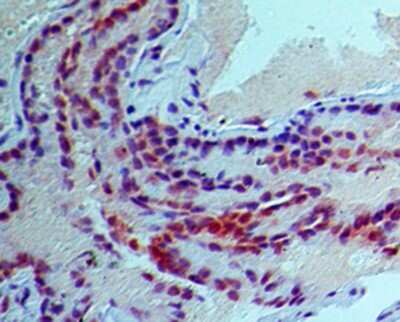 Immunohistochemistry-Paraffin: Siglec-H Antibody (23M14A10) [NBP2-27061] - IHC analysis of formalin-fixed paraffin-embedded tissue section of normal mouse lung using 5 ug/ml concentration of SiglecH antibody (Clone 23M14A10). DAB based detection was used for final staining development.
