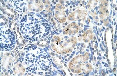 Immunohistochemistry-Paraffin: Signal peptide peptidase-like 2B Antibody [NBP1-59510] - Human kidney Tissue, antibody concentration 4-8ug/ml. Cells with positive label: renal corpuscle cells (indicated with arrows) 400X magnification.