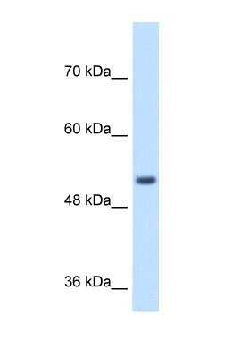 Western Blot: Signal peptide peptidase-like 2B Antibody [NBP1-59510] - Jurkat cell lysate, concentration 1 ug/ml.