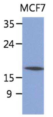 Western Blot: Signal sequence receptor delta Antibody (26G5) [NBP2-42656] - The lysate of MCF7 (40ug) were resolved by SDS-PAGE, transferred to PVDF membrane and probed with anti-human Signal sequence receptor delta antibody (1:1000). Proteins were visualized using a goat anti-mouse secondary antibody conjugated to HRP and an ECL detection system.