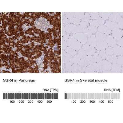 Immunohistochemistry-Paraffin Signal sequence receptor delta Antibody - BSA Free