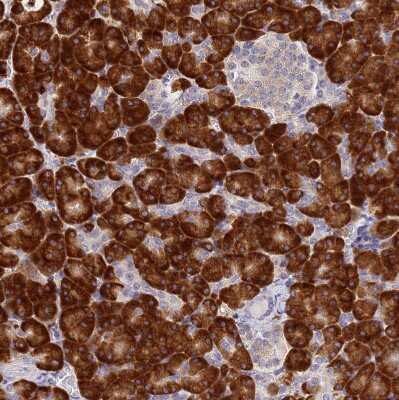 Immunohistochemistry-Paraffin: Signal sequence receptor delta Antibody [NBP1-92390] - Staining of human pancreas shows strong cytoplasmic positivity in exocrine glandular cells.