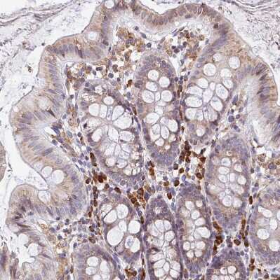Immunohistochemistry-Paraffin: Signal sequence receptor delta Antibody [NBP1-92390] - Staining of human colon shows moderate to strong cytoplasmic positivity in lymphoid cells.