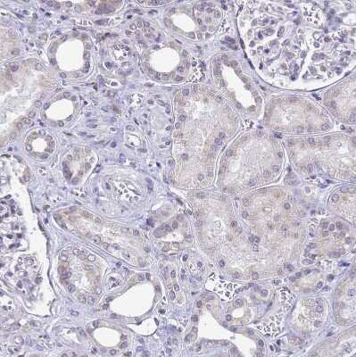 Immunohistochemistry-Paraffin: Signal sequence receptor delta Antibody [NBP1-92390] - Staining of human kidney shows no positivity in cells in tubules as expected.