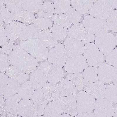 Immunohistochemistry-Paraffin: Signal sequence receptor delta Antibody [NBP1-92390] - Staining of human skeletal muscle shows no positivity in myocytes as expected.