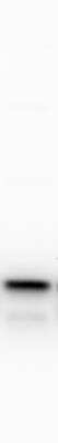 Western Blot: Signal sequence receptor delta Antibody [NBP1-92390] - Analysis of human dermal fibroblasts at 1:500 dilution. Image submitted by a verified customer review.