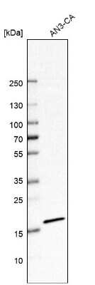 <b>Orthogonal Strategies Validation. </b>Western Blot: Signal sequence receptor delta Antibody [NBP1-92390] - Analysis in human cell line AN3-CA.
