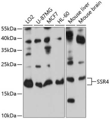 Western Blot: Signal sequence receptor delta Antibody [NBP2-93752] - Analysis of extracts of various cell lines, using Signal sequence receptor delta at 1:1000 dilution. Secondary antibody: HRP Goat Anti-Rabbit IgG (H+L) at 1:10000 dilution. Lysates/proteins: 25ug per lane. Blocking buffer: 3% nonfat dry milk in TBST. Detection: ECL Basic Kit . Exposure time: 5s.