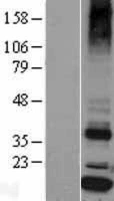Western Blot: Signal sequence receptor delta Overexpression Lysate (Adult Normal) [NBL1-16475] Left-Empty vector transfected control cell lysate (HEK293 cell lysate); Right -Over-expression Lysate for Signal sequence receptor delta.