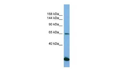 Western Blot: Sin3A-associated protein Antibody [NBP2-84262] - Host: Rabbit. Target Name: SAP130. Sample Type: Jurkat Whole Cell lysates. Antibody Dilution: 1.0ug/mlSAP130 is supported by BioGPS gene expression data to be expressed in Jurkat