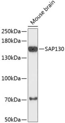 Western Blot: Sin3A-associated protein Antibody [NBP2-94735] - Analysis of extracts of mouse brain, using Sin3A-associated protein at 1:3000 dilution.Secondary antibody: HRP Goat Anti-Rabbit IgG (H+L) at 1:10000 dilution.Lysates/proteins: 25ug per lane.Blocking buffer: 3% nonfat dry milk in TBST.Detection: ECL Basic