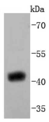 Western Blot: Sir2.1 Antibody (JJ08-83) [NBP2-67869] - Analysis of SIRT2 on human brain lysates using anti-SIRT2 antibody at 1/1,000 dilution.
