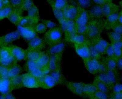 Immunocytochemistry/Immunofluorescence: Sir2.1 Antibody (SN70-04) [NBP2-67707] - Staining SIRT2 in 293 cells (green). The nuclear counter stain is DAPI (blue). Cells were fixed in paraformaldehyde, permeabilised with 0.25% Triton X100/PBS.