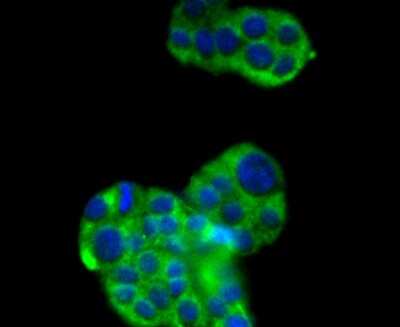 Immunocytochemistry/Immunofluorescence: Sir2.1 Antibody (SN70-04) [NBP2-67707] - Staining SIRT2 in PC-12 cells (green). The nuclear counter stain is DAPI (blue). Cells were fixed in paraformaldehyde, permeabilised with 0.25% Triton X100/PBS.