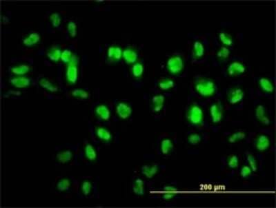 Immunocytochemistry/Immunofluorescence: Sirtuin 1/SIRT1 Antibody (7B7) [H00023411-M01] - Analysis of monoclonal antibody to SIRT1 on HeLa cell. Antibody concentration 10 ug/ml.