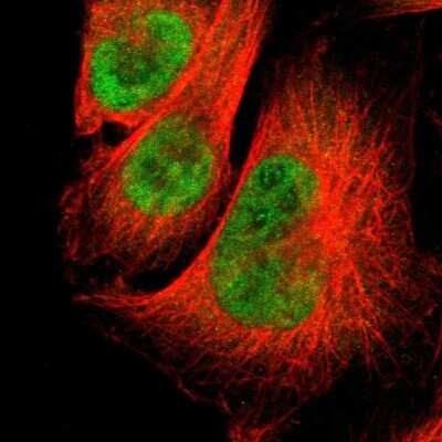 Immunocytochemistry/Immunofluorescence: Sirtuin 1/SIRT1 Antibody [NBP1-87038] - Staining of human cell line U-251 MG shows localization to nucleus & cytosol. Antibody staining is shown in green.