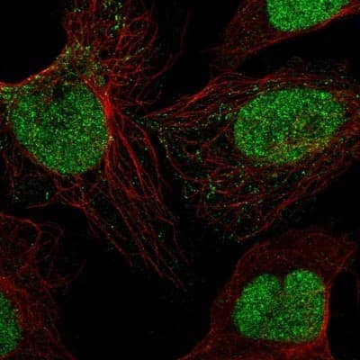 Immunocytochemistry/Immunofluorescence: Sirtuin 1/SIRT1 Antibody [NBP2-56849] - Staining of human cell line U-2 OS shows localization to nucleoplasm & mitochondria.