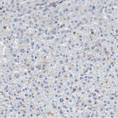 Immunohistochemistry-Paraffin: Sirtuin 1/SIRT1 Antibody [NBP1-87038] - Saining of human liver shows no positivity in hepatocytes as expected.