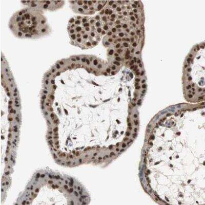 Immunohistochemistry-Paraffin: Sirtuin 1/SIRT1 Antibody [NBP1-87038] - Staining of human placenta shows strong nuclear positivity in trophoblastic cells.