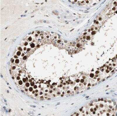 Immunohistochemistry-Paraffin: Sirtuin 1/SIRT1 Antibody [NBP1-87038] - Staining of human testis shows strong nuclear positivity in cells in seminiferous ducts.