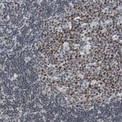 Immunohistochemistry-Paraffin: Sirtuin 1/SIRT1 Antibody [NBP1-87038] - Staining of human lymph node shows moderate to strong nuclear positivity in germinal center cells.