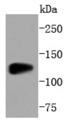 Western Blot: Sirtuin 1/SIRT1 Antibody (SZ04-01) [NBP2-67364] - Analysis of SIRT1 on Jurkat cells lysates using anti-SIRT1 antibody at 1/1,000 dilution.