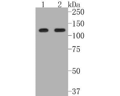 Western Blot: Sirtuin 1/SIRT1 Antibody (SZ04-01) [NBP2-67364] - Western blot analysis of Sirtuin 1/SIRT1 on different lysates. Proteins were transferred to a PVDF membrane and blocked with 5% BSA in PBS for 1 hour at room temperature. The primary antibody (1/500) was used in 5% BSA at room temperature for 2 hours. Goa