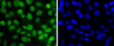 Immunocytochemistry/Immunofluorescence: Sirtuin 1/SIRT1 [p Thr530] Antibody (JJ206-6) [NBP2-67852] - Staining Phospho-SIRT1(T530) in 293 cells (green). The nuclear counter stain is DAPI (blue). Cells were fixed in paraformaldehyde, permeabilised with 0.25% Triton X100/PBS.