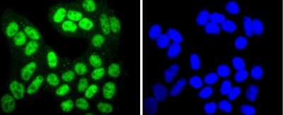 Immunocytochemistry/Immunofluorescence: Sirtuin 1/SIRT1 [p Thr530] Antibody (JJ206-6) [NBP2-67852] - Staining Phospho-SIRT1(T530) in Hela cells (green). The nuclear counter stain is DAPI (blue). Cells were fixed in paraformaldehyde, permeabilised with 0.25% Triton X100/PBS.