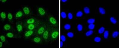 Immunocytochemistry/Immunofluorescence: Sirtuin 1/SIRT1 [p Thr530] Antibody (JJ206-6) [NBP2-67852] - Staining Phospho-SIRT1(T530) in HepG2 cells (green). The nuclear counter stain is DAPI (blue). Cells were fixed in paraformaldehyde, permeabilised with 0.25% Triton X100/PBS.