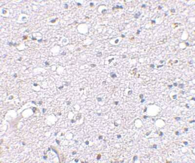 Immunohistochemistry-Paraffin: Sirtuin 2/SIRT2 Antibody [NBP1-76880] - Human brain tissue using Sirt2 antibody at 2.5 ug/ml.