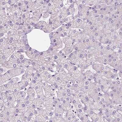 Immunohistochemistry-Paraffin: Sirtuin 2/SIRT2 Antibody [NBP1-87039] - Staining of human liver shows no positivity in hepatocytes as expected.