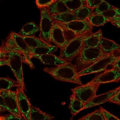 Immunocytochemistry/Immunofluorescence: Sirtuin 2/SIRT2 Antibody (PCRP-SIRT2-1A8) - Azide and BSA Free [NBP3-08293] - Immunofluorescence Analysis of PFA-fixed HeLa cells using Sirtuin 2/SIRT2 Mouse Monoclonal Antibody (PCRP-SIRT2-1A8) followed by goat anti- Mouse IgG-CF488 (green). CF640A phalloidin (red).