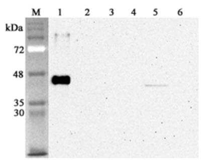 Western Blot: Sirtuin 2/SIRT2 Antibody (S2R233-1) - Azide and BSA Free [NBP2-80049] - Analysis using Sirtuin 2/SIRT2 (human), mAb (S2R233-1) (Prod. No. NBP2-80049) at 1:4'000 dilution.