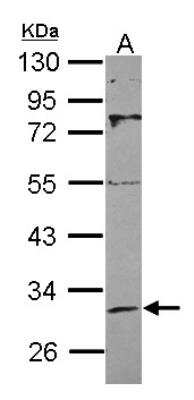 Western Blot: Sirtuin 3/SIRT3 Antibody [NBP2-20371] - Sample (30 ug of whole cell lysate) A: A549 10% SDS PAGE gel, diluted at 1:1000.