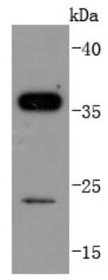 Western Blot: Sirtuin 5/SIRT5 Antibody (JJ084-01) [NBP2-67885] - Analysis of SIRT5 on Jurkat cells lysates using anti-SIRT5 antibody at 1/1,000 dilution.