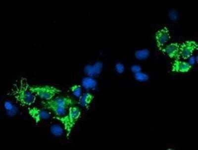 Immunocytochemistry/Immunofluorescence: Sirtuin 5/SIRT5 Antibody (OTI2F1) - Azide and BSA Free [NBP2-74199] - Staining of COS7 cells transiently transfected by pCMV6-ENTRY SIRT5.