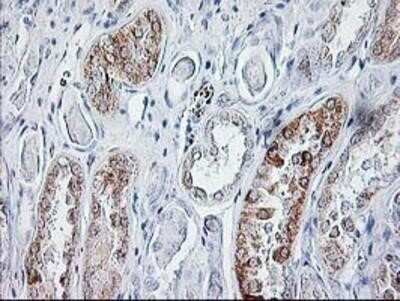 Immunohistochemistry: Sirtuin 5/SIRT5 Antibody (OTI2F1) - Azide and BSA Free [NBP2-74199] - Staining of paraffin-embedded Human Kidney tissue using anti-SIRT5 mouse monoclonal antibody.