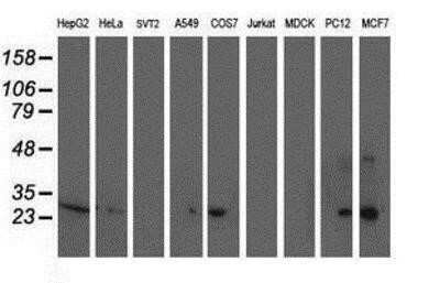 Western Blot Sirtuin 5/SIRT5 Antibody (OTI2F1) - Azide and BSA Free