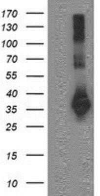 Western Blot Sirtuin 5/SIRT5 Antibody (OTI2F1) - Azide and BSA Free