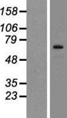 Western Blot: Six5 Overexpression Lysate (Adult Normal) [NBP2-05043] Left-Empty vector transfected control cell lysate (HEK293 cell lysate); Right -Over-expression Lysate for Six5.