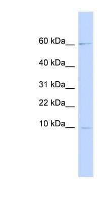 Western Blot: Skalp Antibody [NBP1-62538] - 721_B cell lysate, concentration 0.2-1 ug/ml.