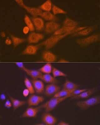 Immunocytochemistry/Immunofluorescence: Skp1 Antibody (10G5X5) [NBP3-16734] - Immunofluorescence analysis of NIH-3T3 cells using Skp1 Rabbit mAb (NBP3-16734) at dilution of 1:100 (40x lens). Blue: DAPI for nuclear staining.