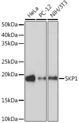 Western Blot: Skp1 Antibody (10G5X5) [NBP3-16734] - Western blot analysis of extracts of various cell lines, using Skp1 Rabbit mAb (NBP3-16734) at 1:1000 dilution. Secondary antibody: HRP Goat Anti-Rabbit IgG (H+L) at 1:10000 dilution. Lysates/proteins: 25ug per lane. Blocking buffer: 3% nonfat dry milk in TBST. Detection: ECL Basic Kit. Exposure time: 90s.