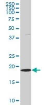 Western Blot: Skp1 Antibody (2E6) [H00006500-M03] - Analysis of SKP1A expression in HeLa (Cat # L013V1).