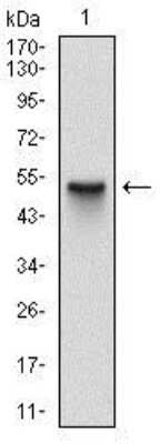 Western Blot: Skp1 Antibody (4E11) [NBP2-37539] - Western blot analysis using SKP1 mAb against human SKP1 (AA: 1-160) recombinant protein. (Expected MW is 43.5 kDa)