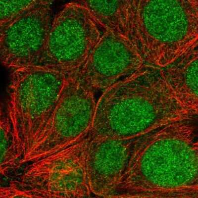 Immunocytochemistry/Immunofluorescence: Skp1 Antibody [NBP2-56707] - Staining of human cell line MCF7 shows localization to nucleus & cytosol.