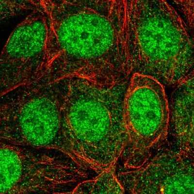 Immunocytochemistry/Immunofluorescence: Skp1 Antibody [NBP2-58725] - Staining of human cell line MCF7 shows localization to nucleus.