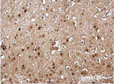 Immunohistochemistry-Paraffin: Skp1 Antibody [NBP2-20380] -  Paraffin-embedded mouse middle brain. SKP1 antibody dilution: 1:500.