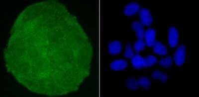 Immunocytochemistry/Immunofluorescence: Skp1 Antibody (JM27-37) [NBP2-67147] - Staining Skp1 in Hela cells (green). The nuclear counter stain is DAPI (blue). Cells were fixed in paraformaldehyde, permeabilised with 0.25% Triton X100/PBS.